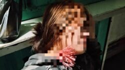 Makassar Darurat Geng Motor, Perempuan 22 Tahun Jadi Korban Pembusuran di Panakkukang