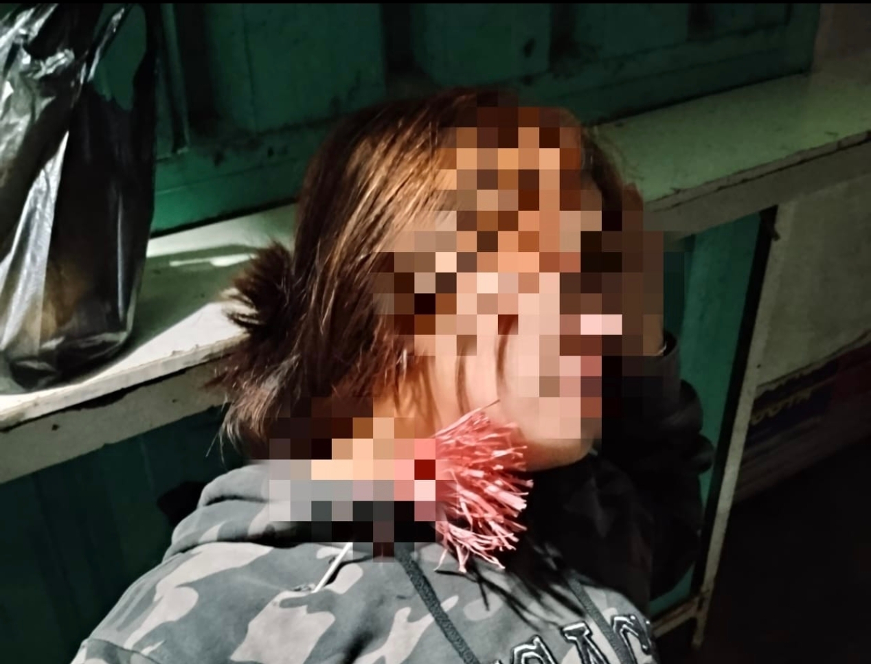 Makassar Darurat Geng Motor, Perempuan 22 Tahun Jadi Korban Pembusuran di Panakkukang