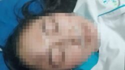 Punya Pacar Baru, Perawat Dianiaya Dokter Spesialis karena Terbakar Api Cemburu